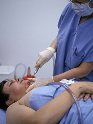 面部吸脂要謹(jǐn)慎