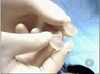 盤點2011十大整形奇聞