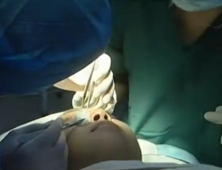 無資質(zhì)整形機(jī)構(gòu)至整形“返修”事件頻發(fā)