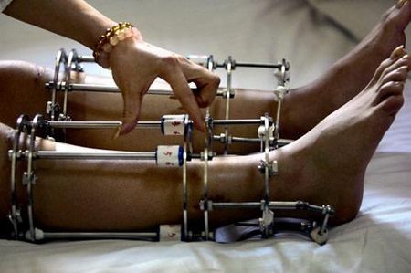 各國(guó)美麗標(biāo)準(zhǔn) 西非以胖為美鐘情長(zhǎng)腿