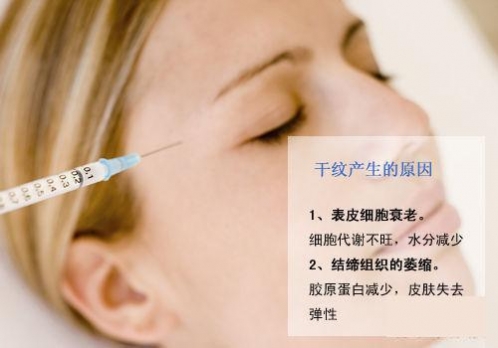 25歲干紋初現(xiàn) 注射vs激光對(duì)癥下藥