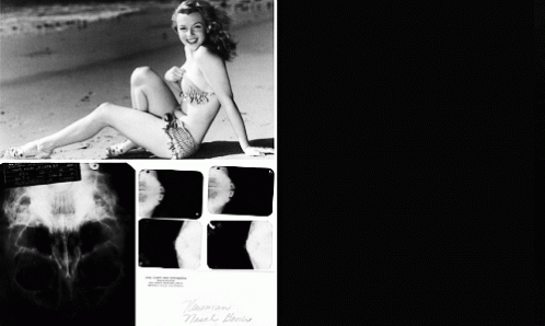 瑪麗蓮·夢露下巴整形診斷單和X光片將被拍賣