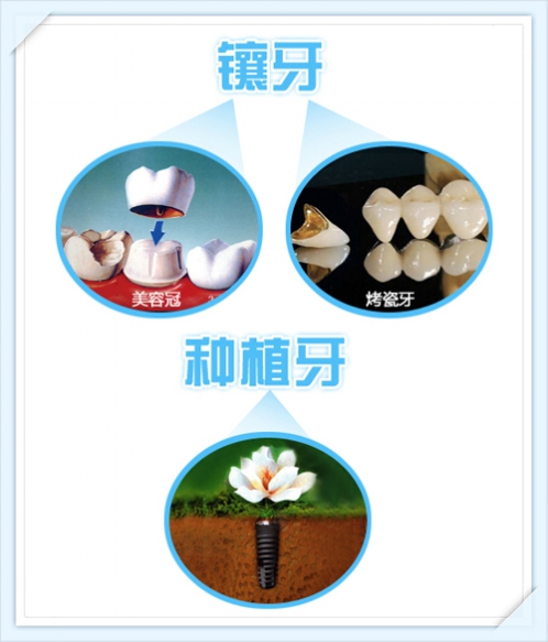 說說種植牙那些事兒 徐連來院長(zhǎng)專訪記