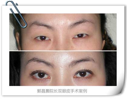 郭昌灝院長(zhǎng):女人變美 不僅僅依靠整形