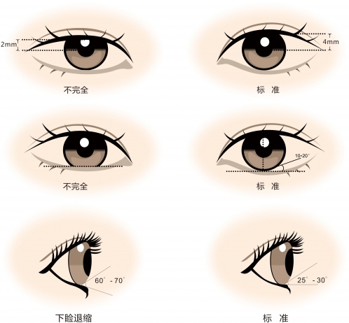 <!--<i data=20240703-sp></i>-->：美眼不止是割個雙眼皮而已