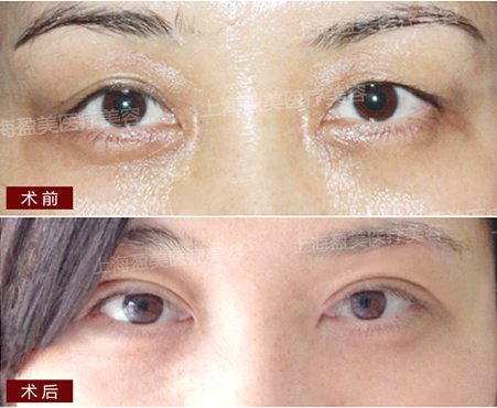 氣質(zhì)女醫(yī)生楊璐：執(zhí)著的完美主義者