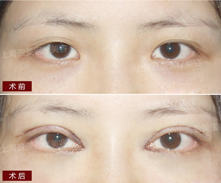 氣質(zhì)女醫(yī)生楊璐：執(zhí)著的完美主義者