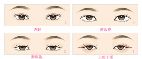 郝寶慧醫(yī)生：想要“天然美眼”我?guī)湍? titlle=