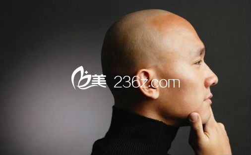 男人為什么會比較容易出現(xiàn)禿頂