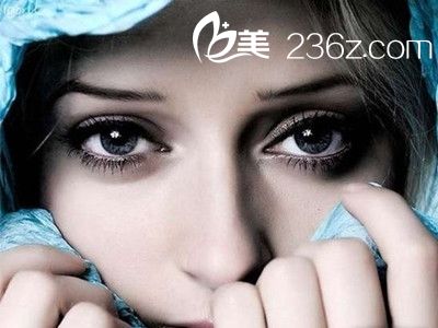 歐式雙眼皮適合哪些人做？