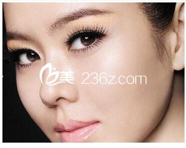 隆鼻假體取出后