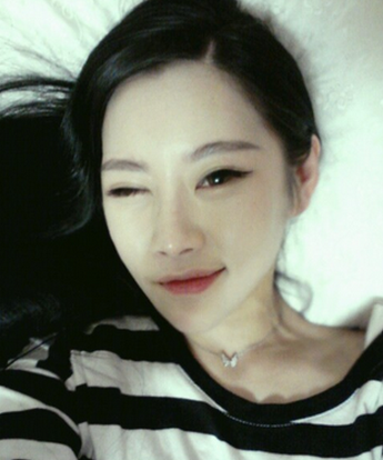 姐妹們好，我9個(gè)月前做了V-LINE整形！下面是術(shù)前的照片其