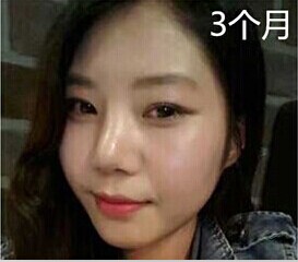 我的臉一直都很寬，讀書(shū)的時(shí)候同學(xué)給我取的外號(hào)是大臉貓。