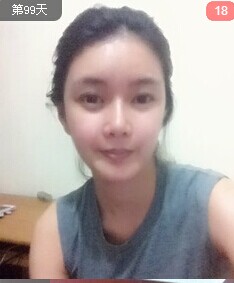 這是我手術(shù)前的樣子,以前的我沒(méi)有對(duì)外貌有特別的不滿,所以