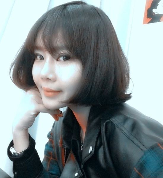 大家好！我做隆鼻再手術，面部脂肪填充2次，開前眼角已經(jīng)1年了